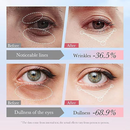 Eye Cream with 30% Retinol, 10% Hyaluronic Acid, 5% Nicotinamide, 10% Vitamin C for Puffy Bags Fine Lines Dark Circles Wrinkles, Under Eye Cream with 360° Roller Massage Ball, 0.7 fl. oz