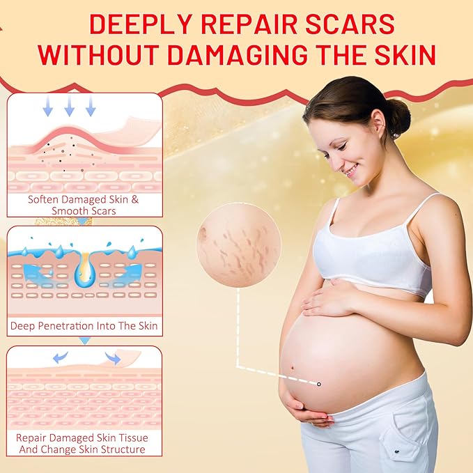 Stretch Mark Oil for Pregnancy, Skincare fl.oz