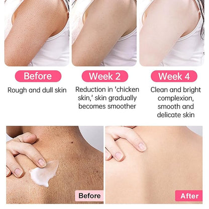 Strawberry Legs Treatment For Women,Bump Eraser