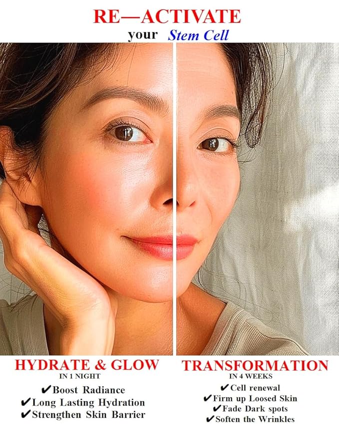 ULTIMATE [Human Stem Cell + (10%) PDRN] Healing Booster Overnight Serum―for Minimizes Wrinkles, Discoloration (10ml x 5vials)