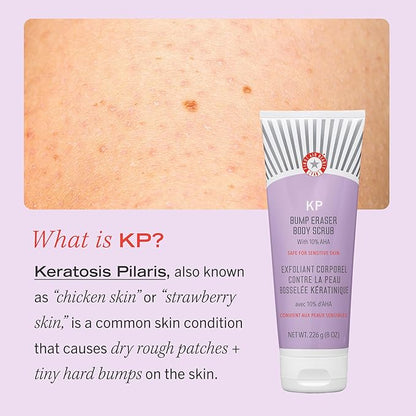 First Aid Beauty - KP Bump Eraser Body Scrub with 10% AHA, Keratosis Pilaris Skin Exfoliator with Glycolic and Lactic acids, Helps Reduce Chicken Skin Bumps, Safe for Sensitive Skin, 2 oz