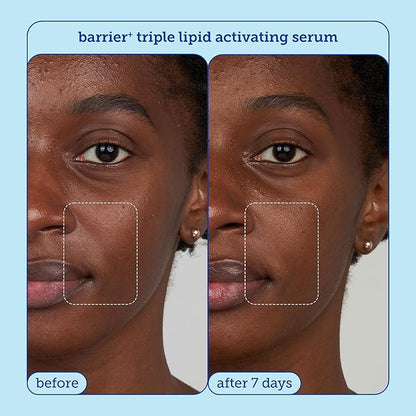 Skinfix Barrier + Firm Trio - Full-Size Plumping Serum, Mini Moisturizer, Mini Eye Cream with Patented B-L3™ Complex - Hydrate & Strengthen Skin Barrier