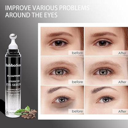 Caffeine Eye Cream - Eye Serum with 5% Caffeine & 5% Retinol Anti-Aging Formula with Hyaluronic Acid Niacinamide & Peptides for Dark Circles, Puffiness & Fine Lines – 360° Massage Roller Ball