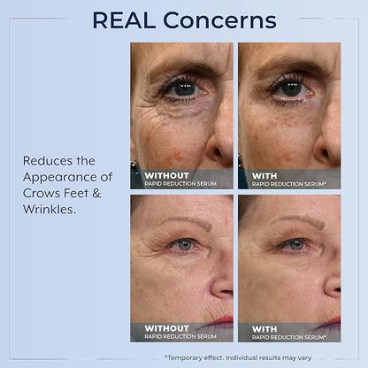 Plexaderm Rapid Reduction Eye Serum - Visibly Reduces Under-Eye Bags, Wrinkles, Dark Circles, Fine Lines & Crow's Feet Instantly, Anti Aging Wrinkle Remover for Face, 3 Full Size Tubes