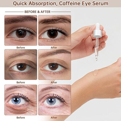 The Caffeine Solution 5% + EGCG，Reduces Appearance of Eye Contour Pigmentation and Puffiness，Under Eye Serum (30ml) Caffeine For Face Moisturizing Serum (1)