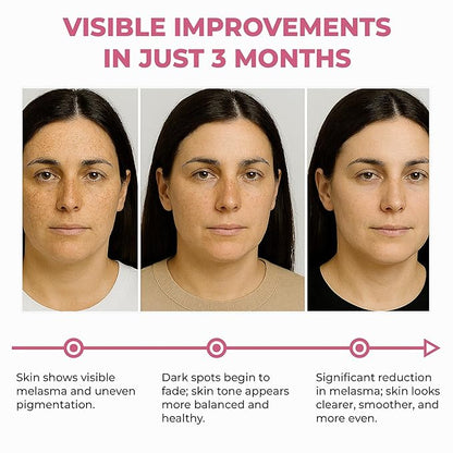 Abera Skin Renewing Serum, Melasma Treatment For Face, High-Performance Anti-Aging, High Potency Saffron Extract, Hydrating Serum,1.01 Fl Oz