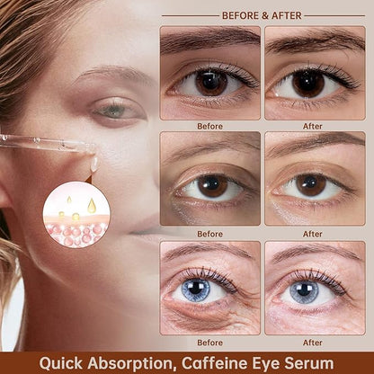 Caffeine Solution 5% + EGCG For Dark Circles & Puffiness, 2 PCS Anti Aging Caffeine Under Eye Serum For Eye Bags, Fine Lines, Moisturizing Caffeine Solution.