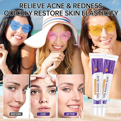 Azelaic Acid 12% Cream For Face, Azelaic Acid Acne Cream For Rosacea Treatment, Redness Relief, 2PCS Azelaic Acid Serum With Salicylic Acid & Niacinamide For Dark Spot, Skin Care.