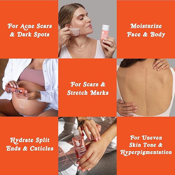 Bio-Oil Dry Skin Travel Skincare Bundle 1.7 Oz