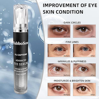 5% Caffeine Eye Serum, Anti-Aging Eye Cream with 360°Massage Roller, Eye Serum for Dark Circles and Puffiness, Reduces Fine Lines and Puffiness Under the Ryes, 20ML, For Men and Women.