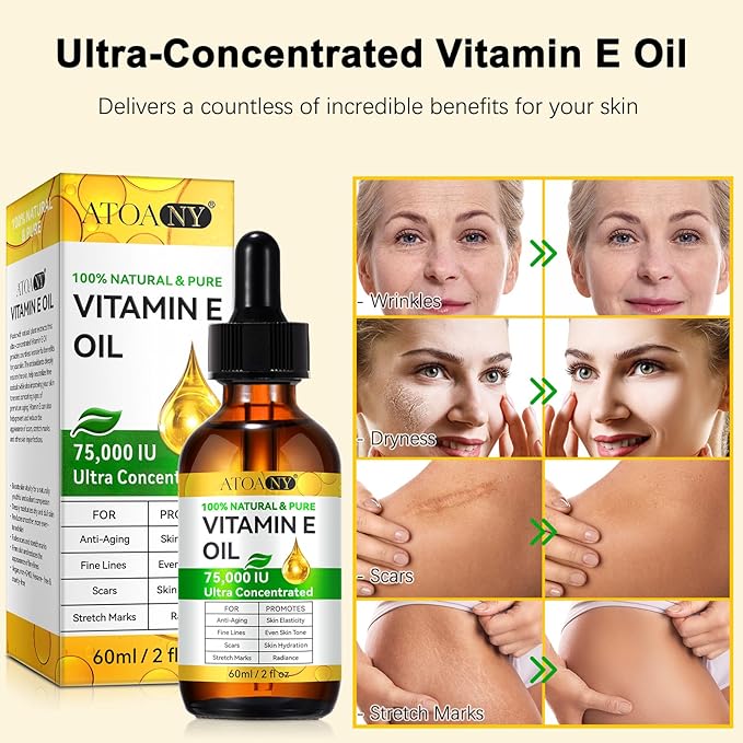 Vitamin E Oil for Skin 75,000 IU – 2 Pack Organic Vitamin E for Face, Hair, Scars, Nails, Ultra-Hydrating Body Oil for Dry Skin Wrinkles,Cold-Pressed, Non-GMO, Organic Skincare Formula –2 Fl Oz