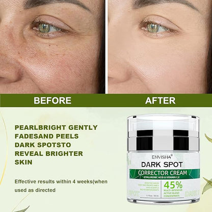 Dark Spot Remover Corrector for Face and Body, Dark Spot Corrector Cream,Moisturizer-Remover Sun Spot, Age Spot,Melasma, Freckles,Brown Spot Hyperpigmentation for Men and Women