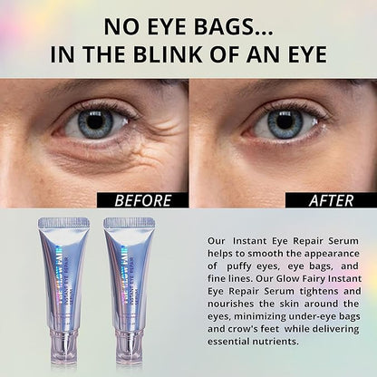 Eye Repair Serum (10g) – Under Eye Cream for Dark Circles, Puffiness, Fine Lines & Crow's Feet – Hydrate, Moisturize & Revitalize Skin with Caffeine Complex (2 Pack)