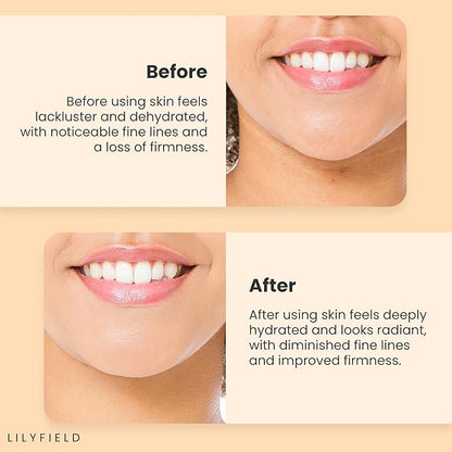 LILYFIELD Wrinkle Correcting Serum with Phyto Collagen & Vitamin C. Korean Skincare. Anti-Aging, Target Dark Spots and Fine lines,Smoothing, All Skin Types. Korean Skin care 30ml, 1 fl. oz
