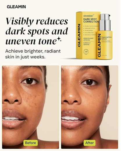 Gleamin Superactive Vitamin C Serum – 15% Vitamin C, 3% Tranexamic Acid, 4% Niacinamide & Bakuchiol – Reduces Discoloration, Uneven Tone, Brightens Skin & Smooths Texture – Fragrance-Free, 1 fl oz
