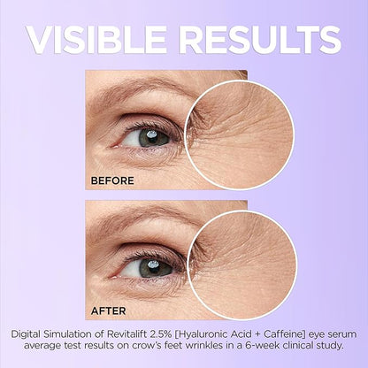 L'Oreal Paris Revitalift Hyaluronic Acid + Caffeine Hydrating Eye Serum for Dark Circles, Fragrance Free .67 fl. oz + Moisturizer Sample