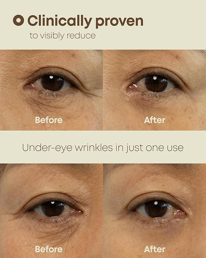 Ever-Youth Dual Effect Eye Cream Korean Skincare Instant Lifting Technology for Firm Eyes with Niacinamide Adenosine Hyaluronic Acid Ceramides for Fine Lines Bags Puffiness 0.5 fl oz