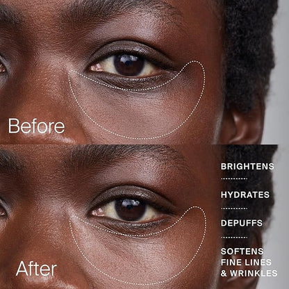 Timeline The Eye Cream - Anti-Aging Cream for Wrinkles, Dark Circles & Under Eye Bags with Urolithin A & Niacinamide (15 ml)