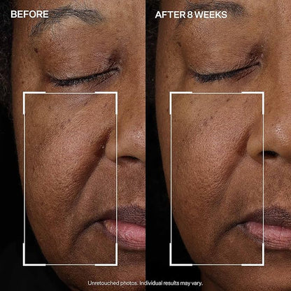 StriVectin Tighten and Lift Peptight Face Lift Serum with Tightening and Brightening Peptides for Wrinkles, Under Eye Bags and Puffiness, 30 mL
